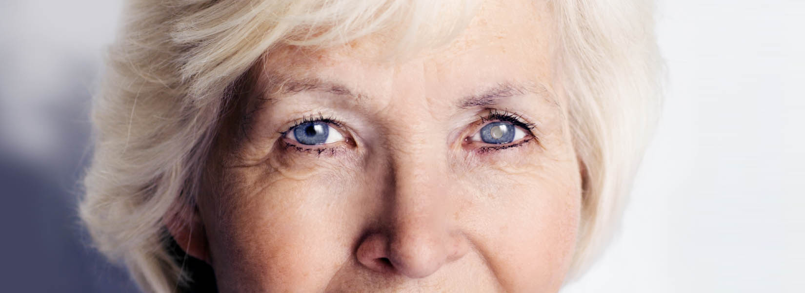 Cataract Surgery in Southside